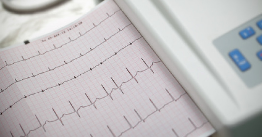 Webinář na Téma AKUTNÍ KARDIOLOGIE