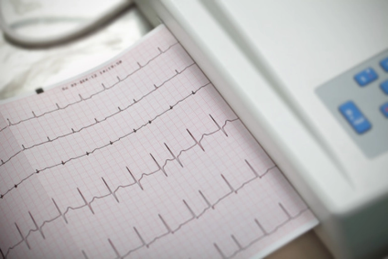 Webinář na Téma AKUTNÍ KARDIOLOGIE